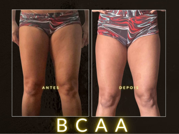 BCAA Gordura Localizada em Realengo RJ