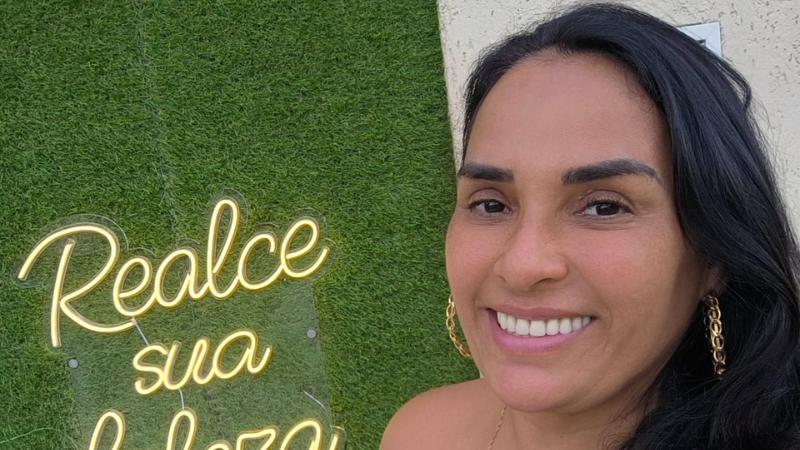 Dra. Daniele Andrade - Harmonização Facial em Realengo RJ